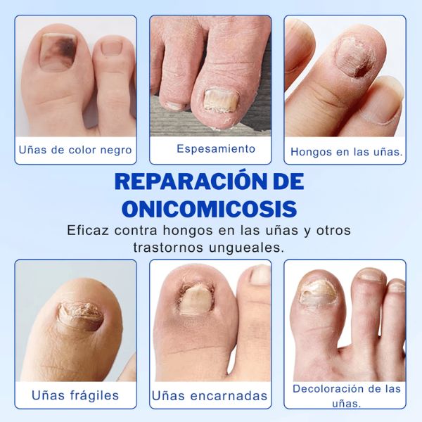 Cuida la apariencia de tus uñas cada noche, de forma simple y práctica