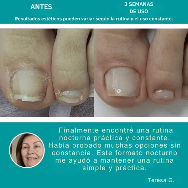 Cuida la apariencia de tus uñas cada noche, de forma simple y práctica
