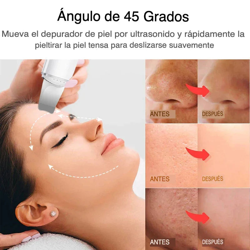 Exfoliador Ultrasónico Para Una Piel Radiante Tienda